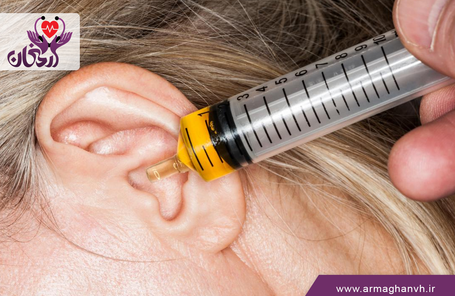 شستشوی گوش در منزل شهریار|شستشوی گوش و تخلیه جرم گوش در شهریار