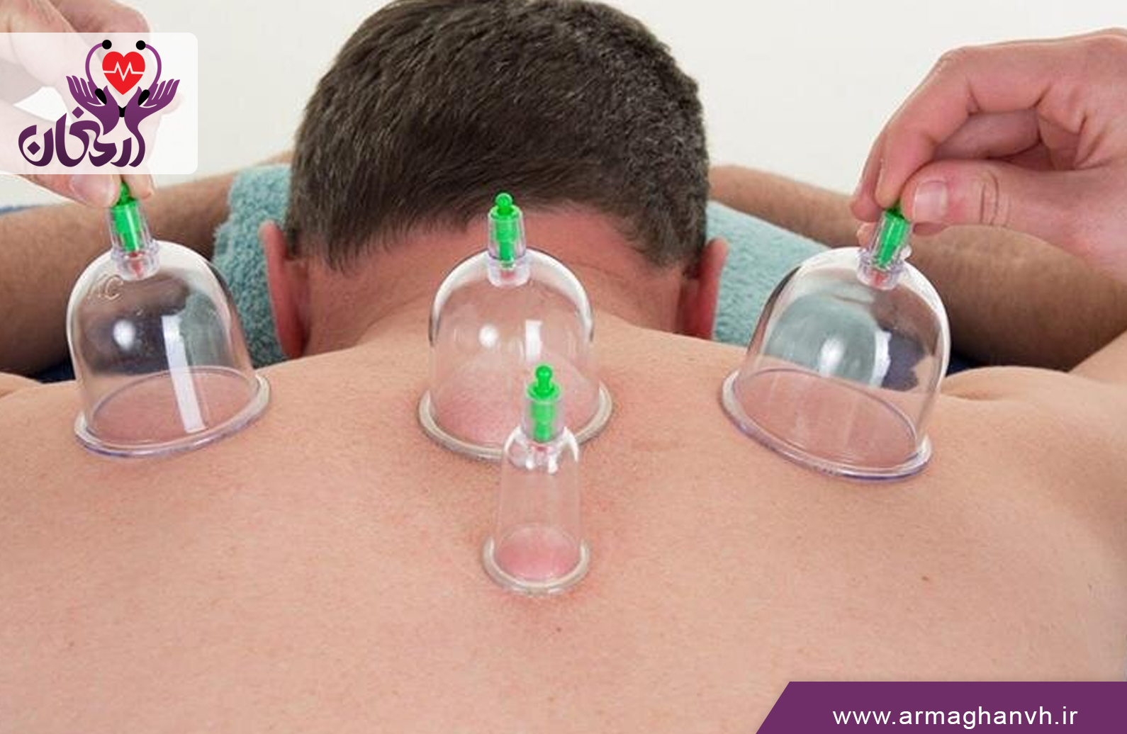 خدمات حجامت در منزل شهریار|