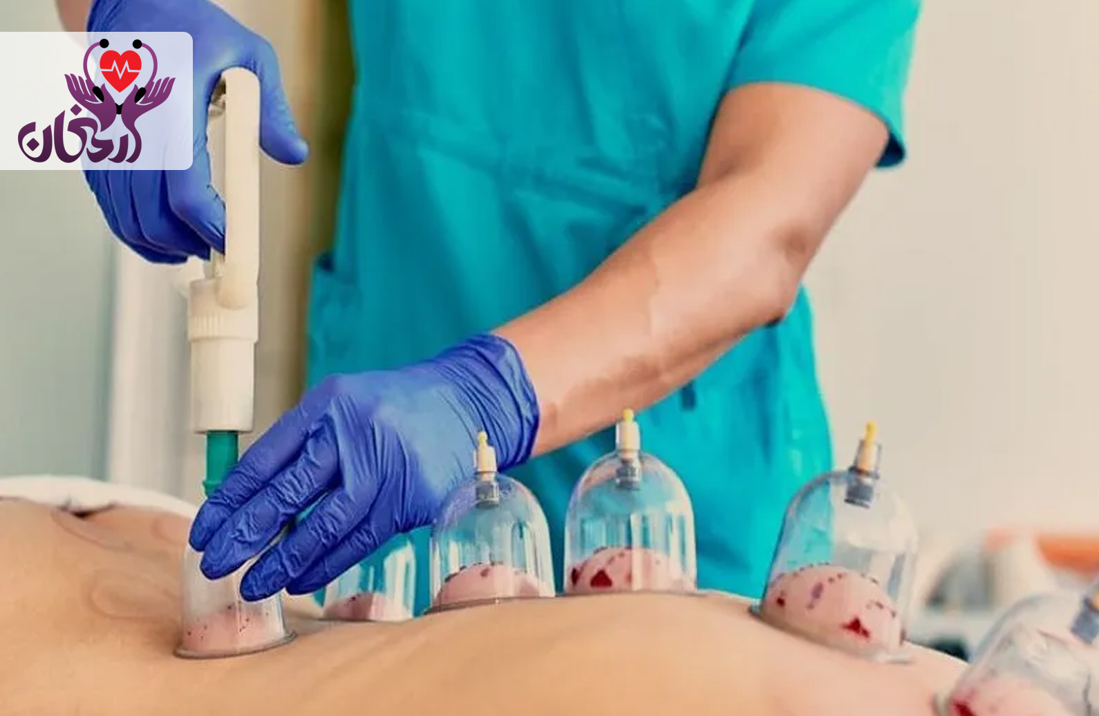 فواید حجامت در تصفیه خون و بهبود سلامت بدن