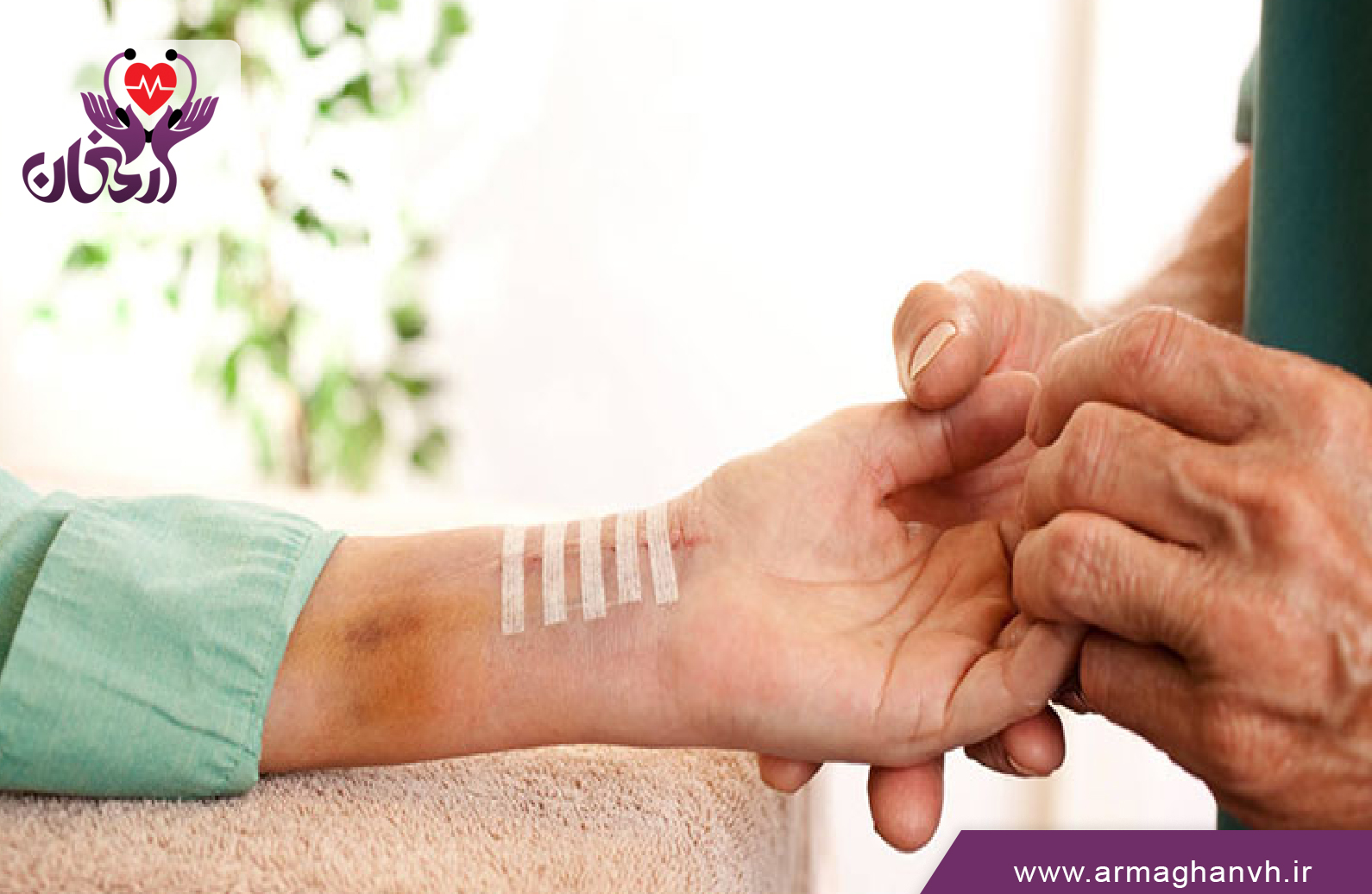 بخیه زدن و کشیدن بخیه در منزل شهریار|خدمات پرستاری در منزل شهریار
