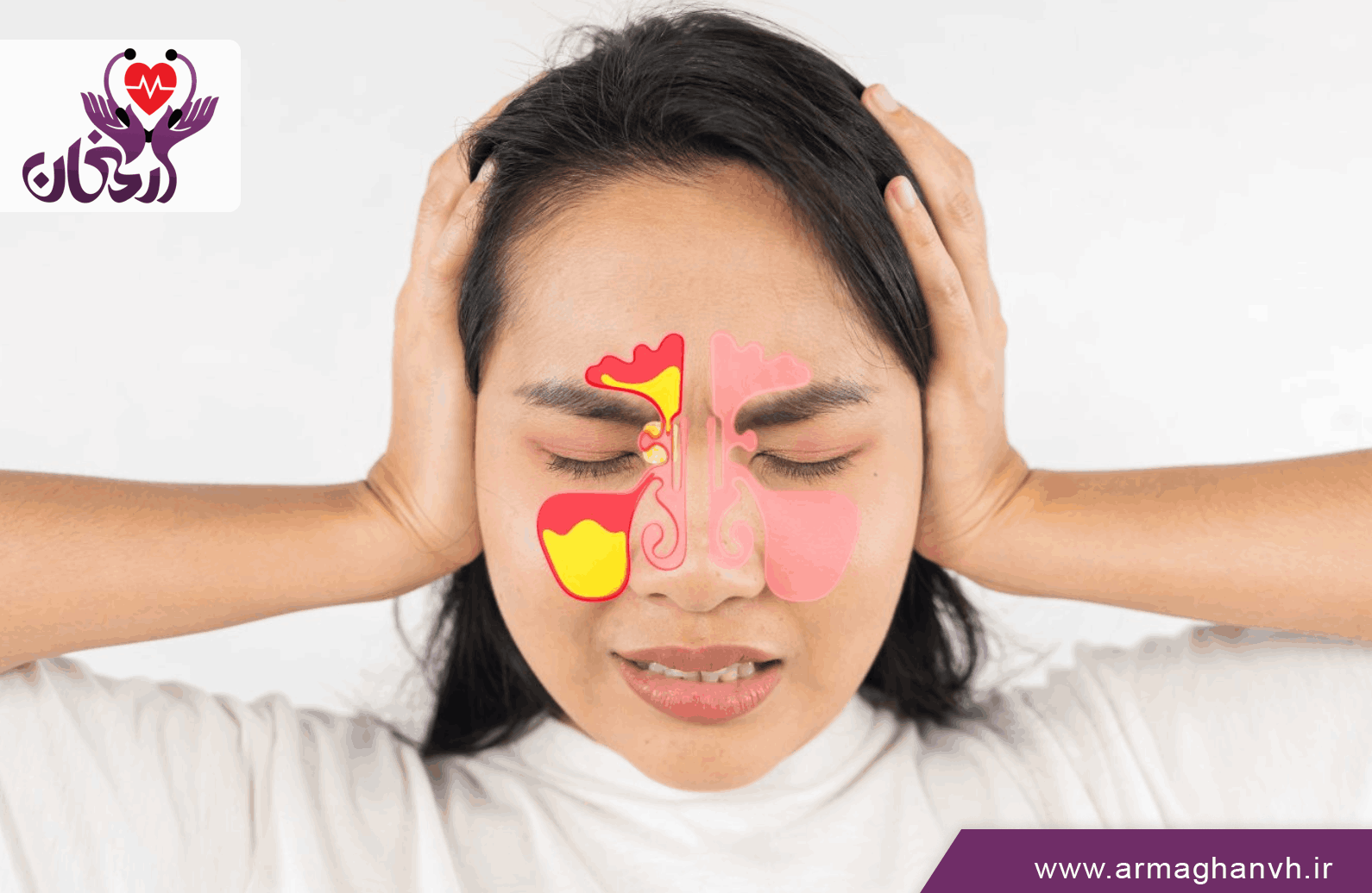 انواع سینوزیت کدامند؟