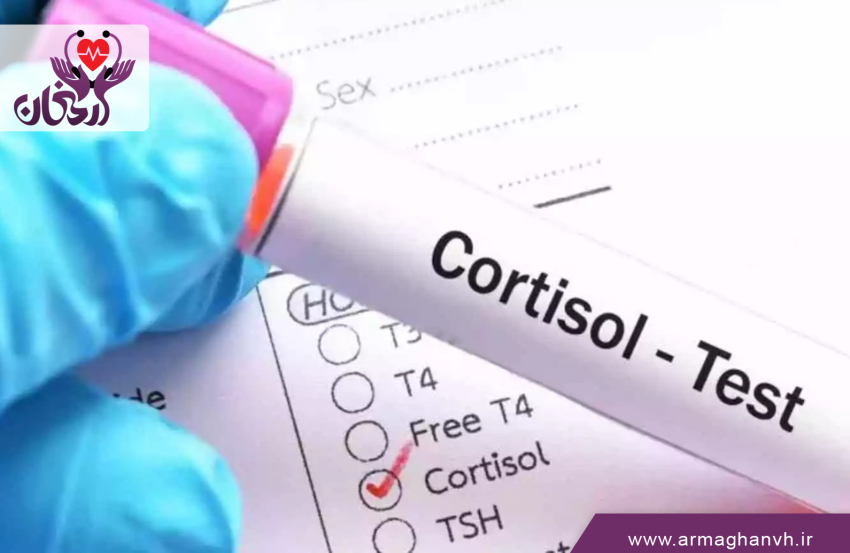 سنجش میزان کورتیزول (Cortisol Test)