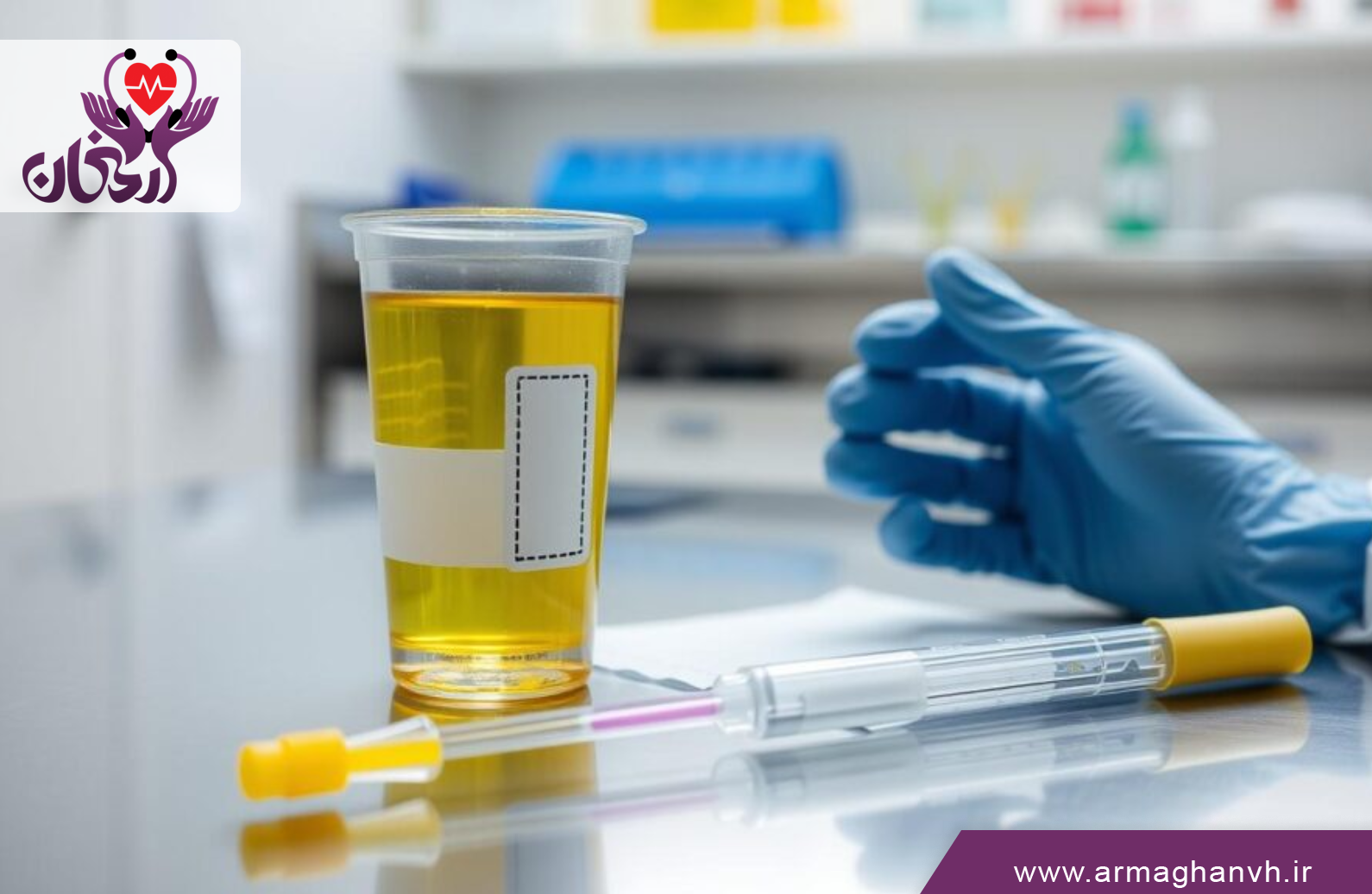 آزمایش ادرار در منزل شهریار؛ راحت، سریع و بدون معطلی