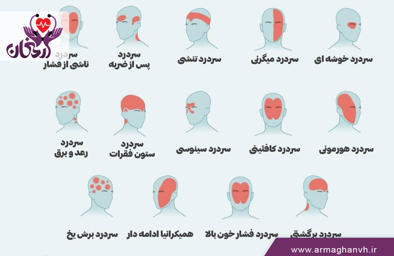 علت انواع مختلف سردرد چیست؟